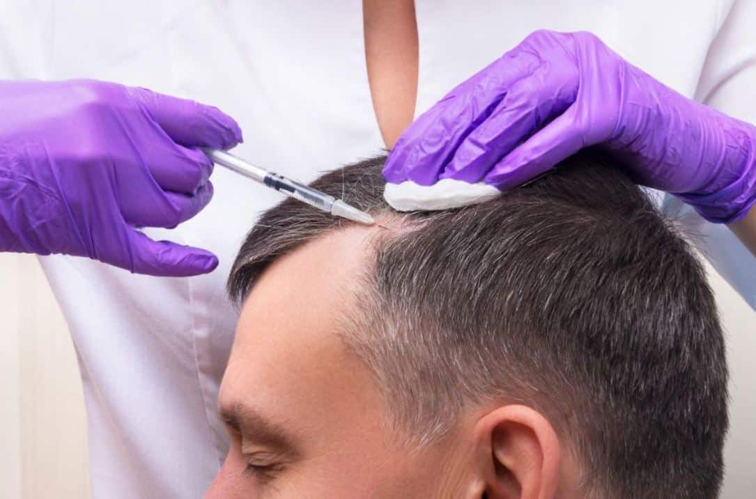 Hair Transplant Istanbul: Why It’s the Global Hair Transplant Hub